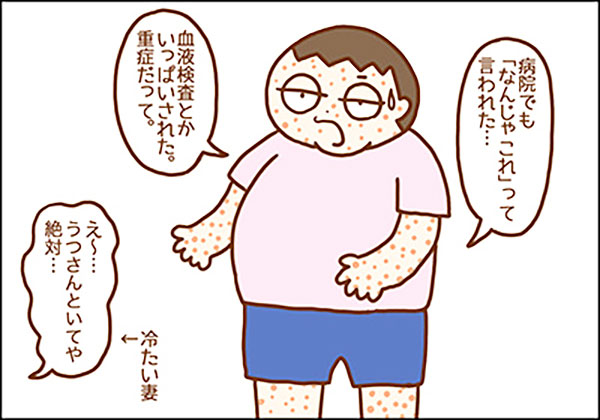 大人の手足口病